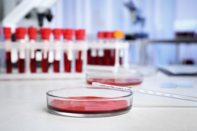 Photo of Petri dish with blood sample for analysis on table in laboratory