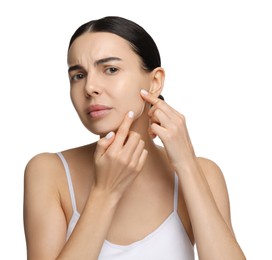 Young woman with dry skin on white background