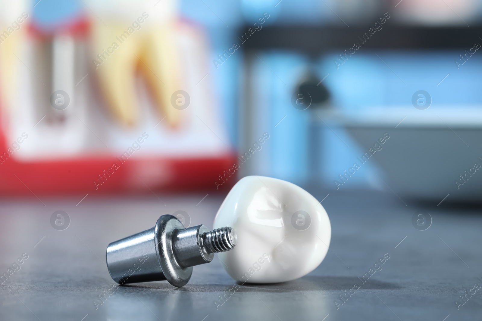 Photo of Abutment and crown of dental implant on table in clinic, closeup