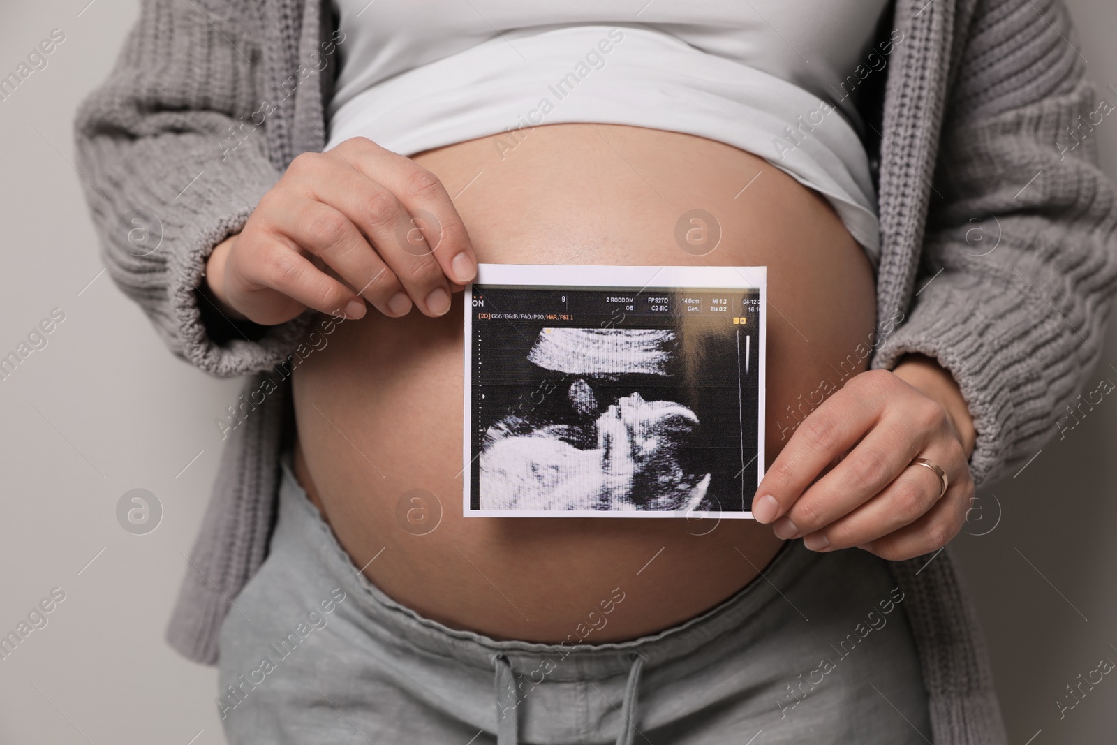 Photo of Young pregnant woman with ultrasound picture of baby on grey background, closeup