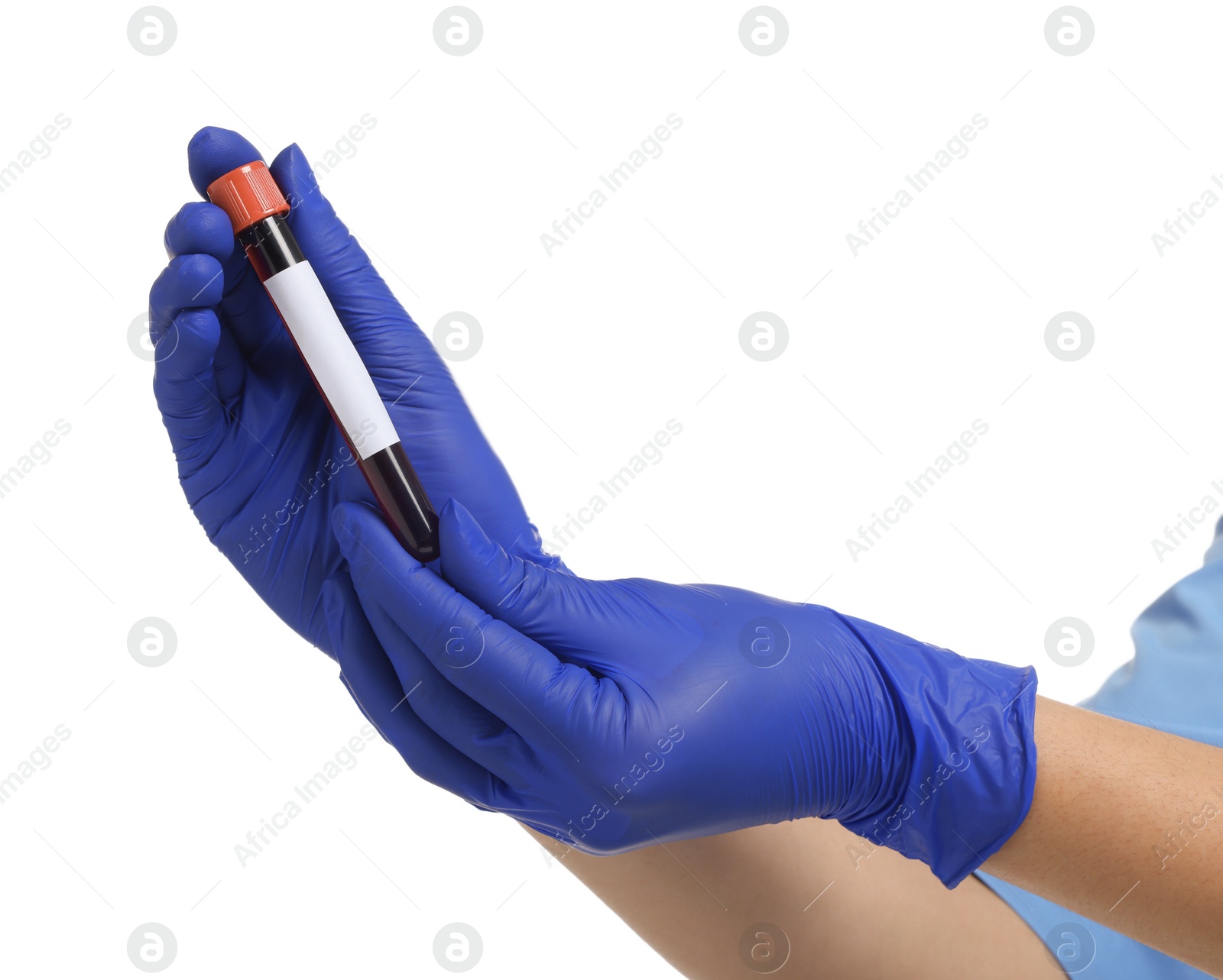 Photo of Laboratory testing. Doctor with blood sample in tube on white background, closeup