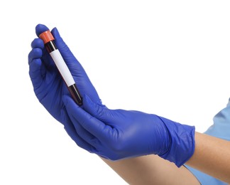 Photo of Laboratory testing. Doctor with blood sample in tube on white background, closeup