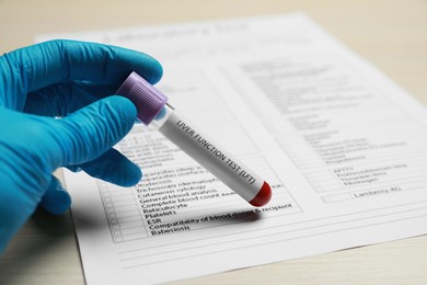 Photo of Liver Function Test. Laboratory worker with tube of blood sample and form at table, closeup