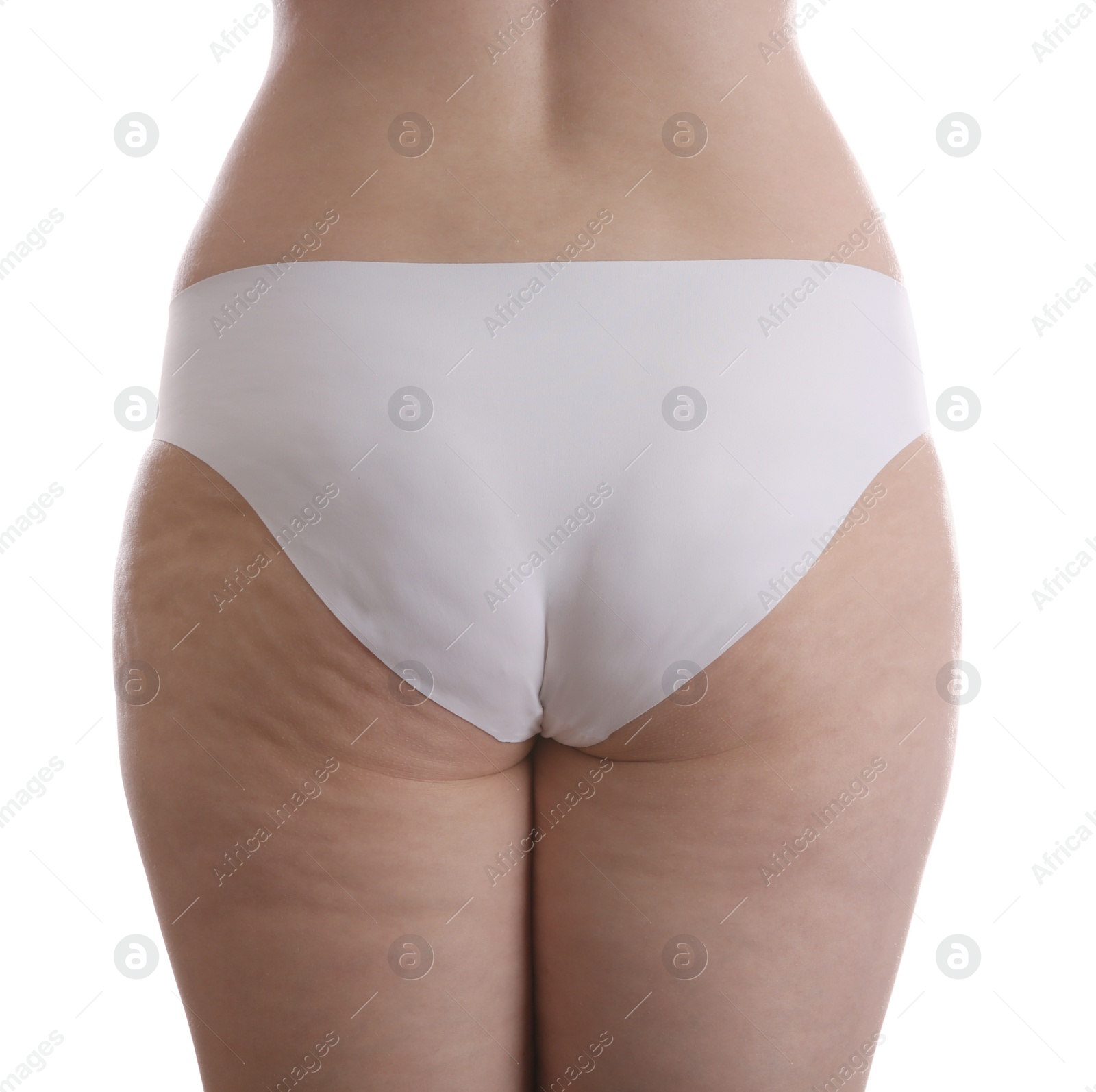 Photo of Woman with cellulite on white background, closeup