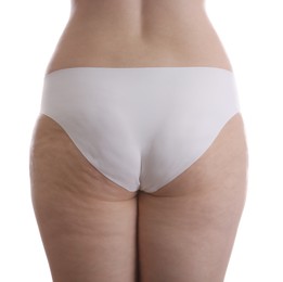 Photo of Woman with cellulite on white background, closeup