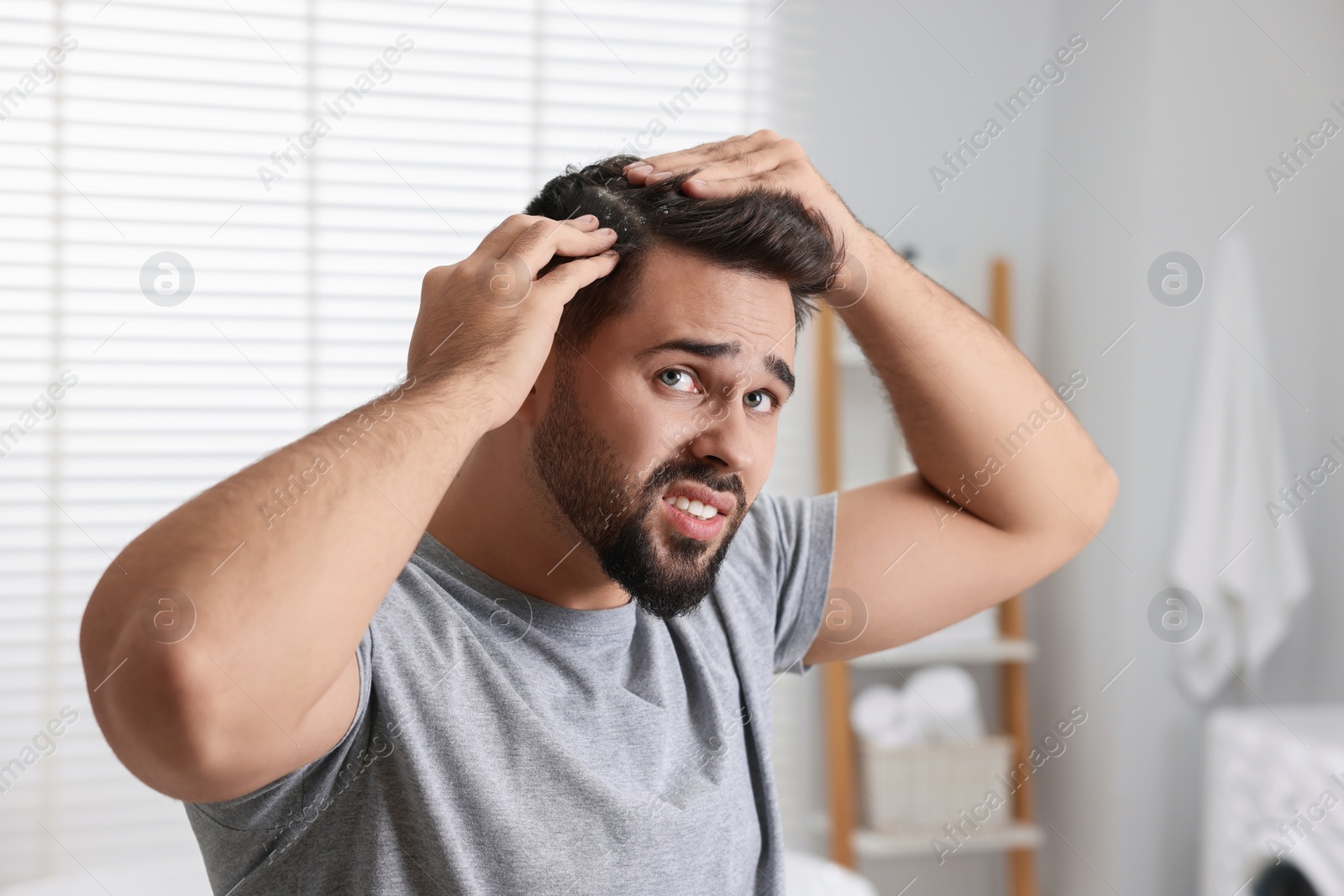 Photo of Emotional man with dandruff in his dark hair in bathroom