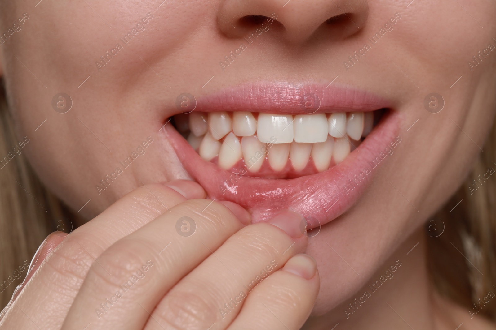 Photo of Young woman showing healthy gums, closeup view