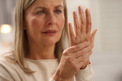 Mature woman suffering from pain in hand on blurred background, selective focus. Rheumatism symptom