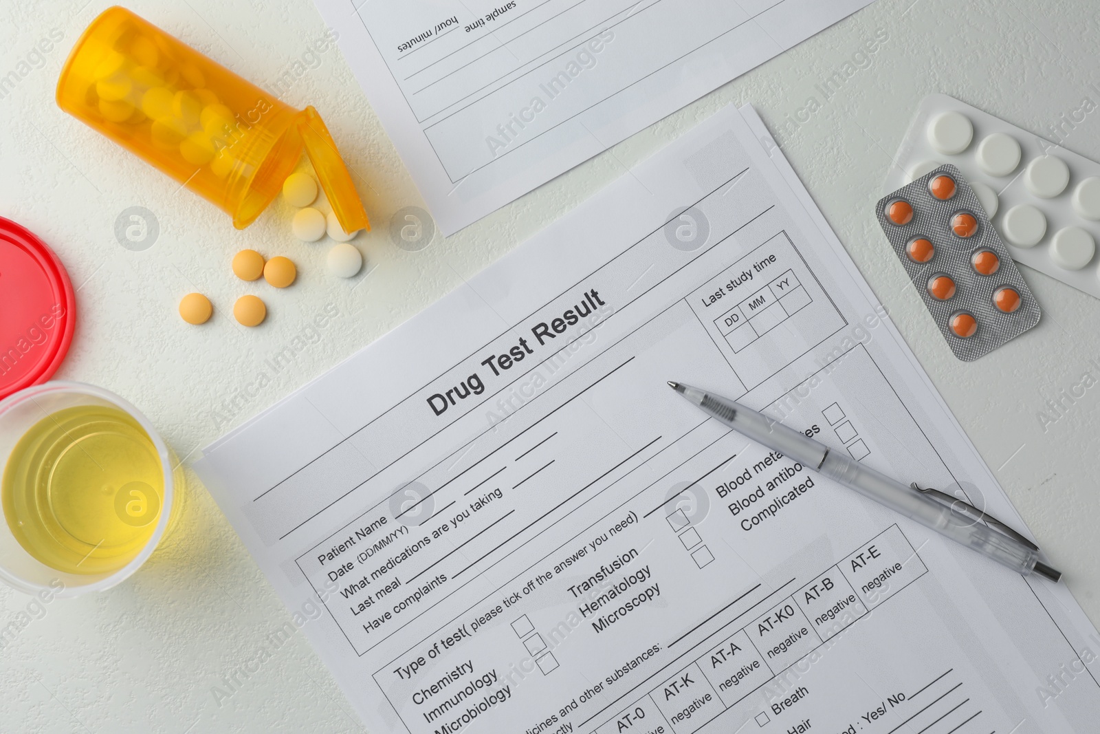 Photo of Drug test result form, container with urine sample and pills on light table, flat lay