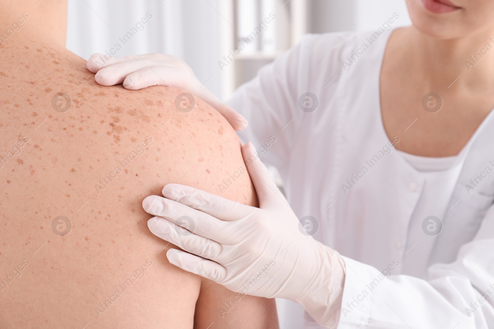 Photo of Doctor examining patient in clinic, closeup view. Visiting dermatologist