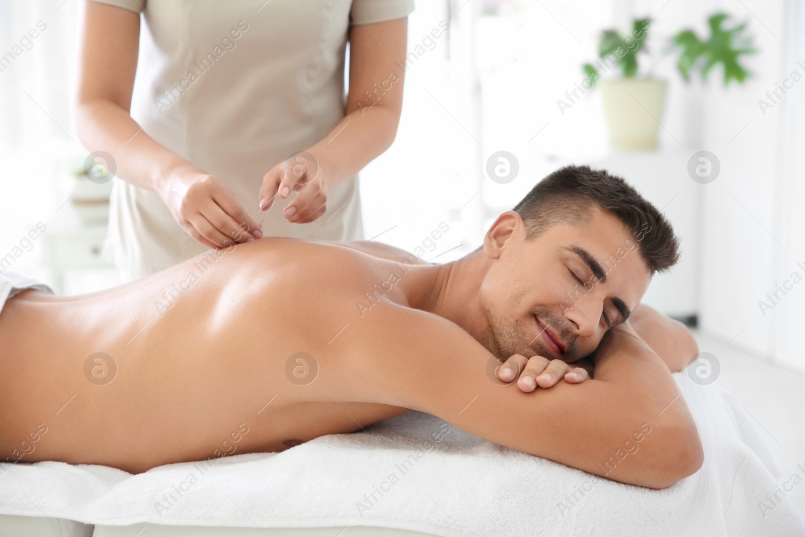 Photo of Young man undergoing acupuncture treatment in salon