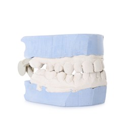 Dental model with gums isolated on white. Cast of teeth