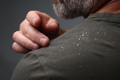 Photo of Bearded man brushing dandruff off his t-shirt on grey background, closeup