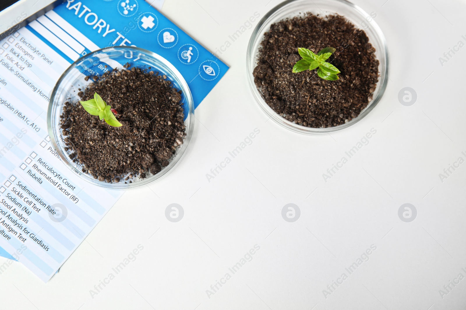 Photo of Petri dishes with soil and sprouted plants on white table, flat lay. Biological chemistry