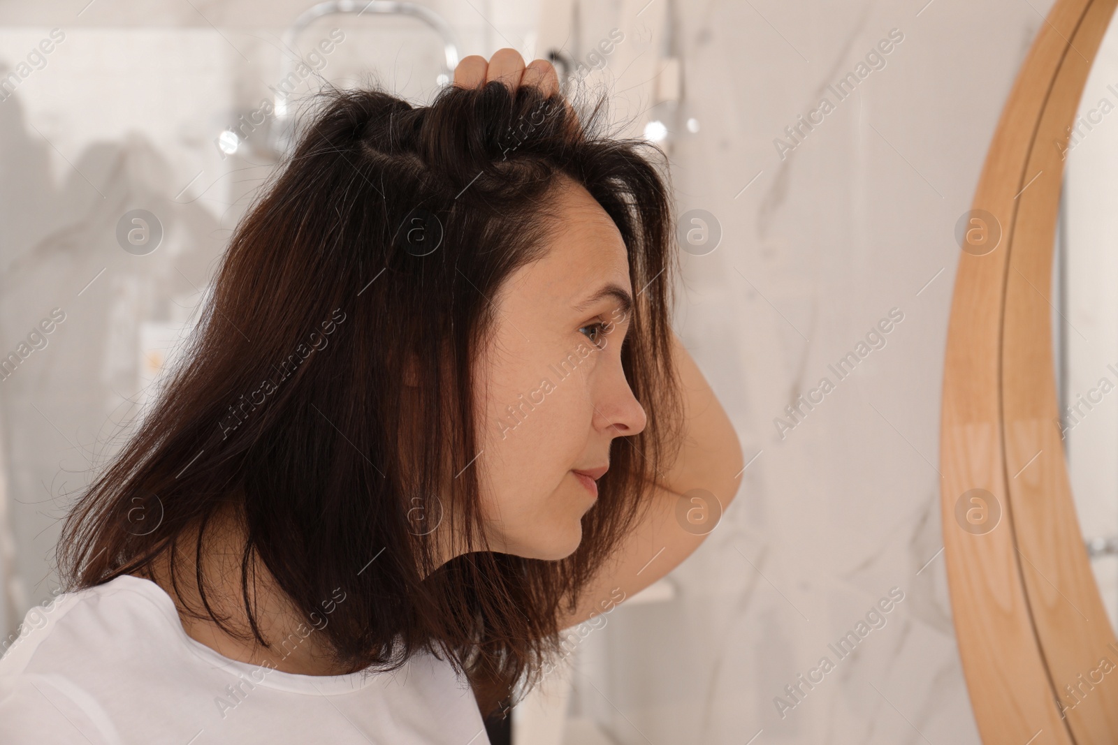 Photo of Mature woman suffering from baldness at home