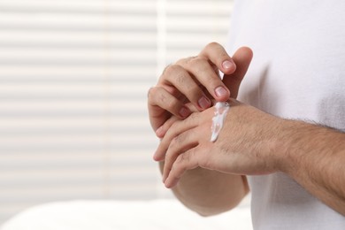 Photo of Man with dry skin applying cream onto his hand indoors, closeup. Space for text