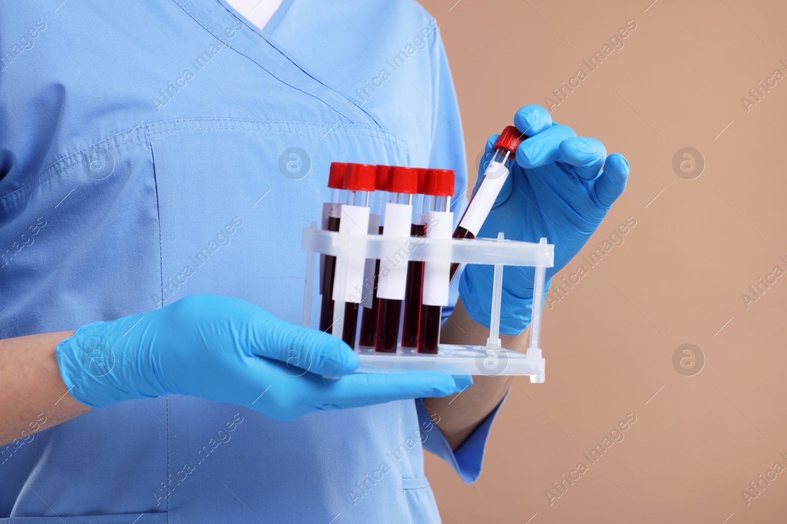 Photo of Laboratory testing. Doctor with blood samples in tubes on light brown background, closeup