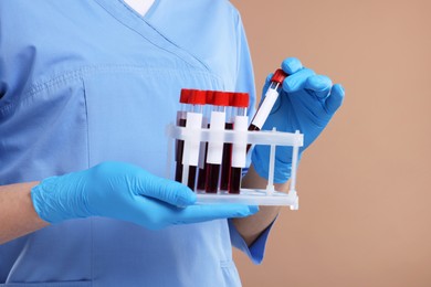 Photo of Laboratory testing. Doctor with blood samples in tubes on light brown background, closeup