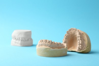 Photo of Dental model with gums on light blue background. Cast of teeth
