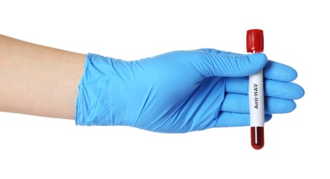 Photo of Scientist holding tube with blood sample and label Anti HAV on white background, closeup