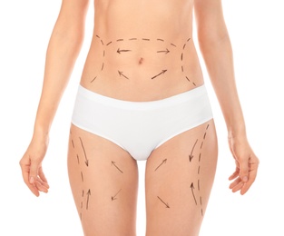 Woman with marks on body for cosmetic surgery operation against white background, closeup