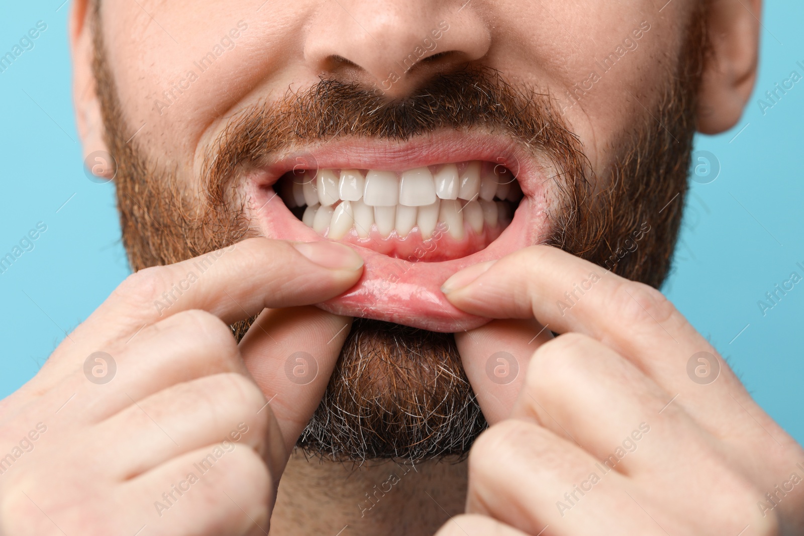 Photo of Man showing his healthy teeth and gums on light blue background, closeup