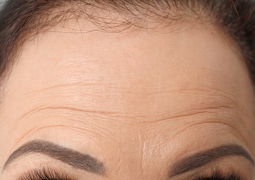 Photo of Beautiful older woman, closeup of forehead
