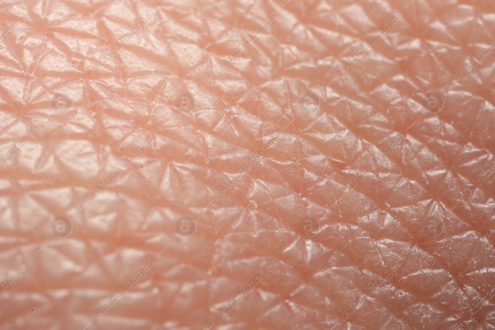 Photo of Texture of dry skin as background, macro view