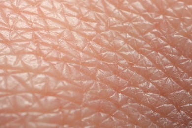 Texture of dry skin as background, macro view