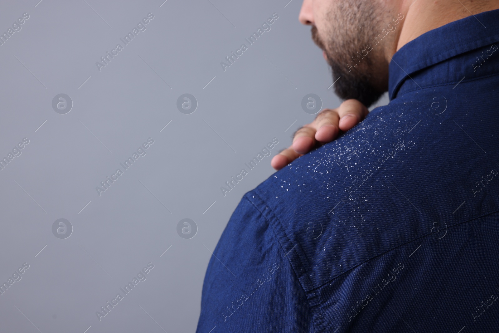 Photo of Man brushing dandruff off his shirt on grey background, closeup. Space for text