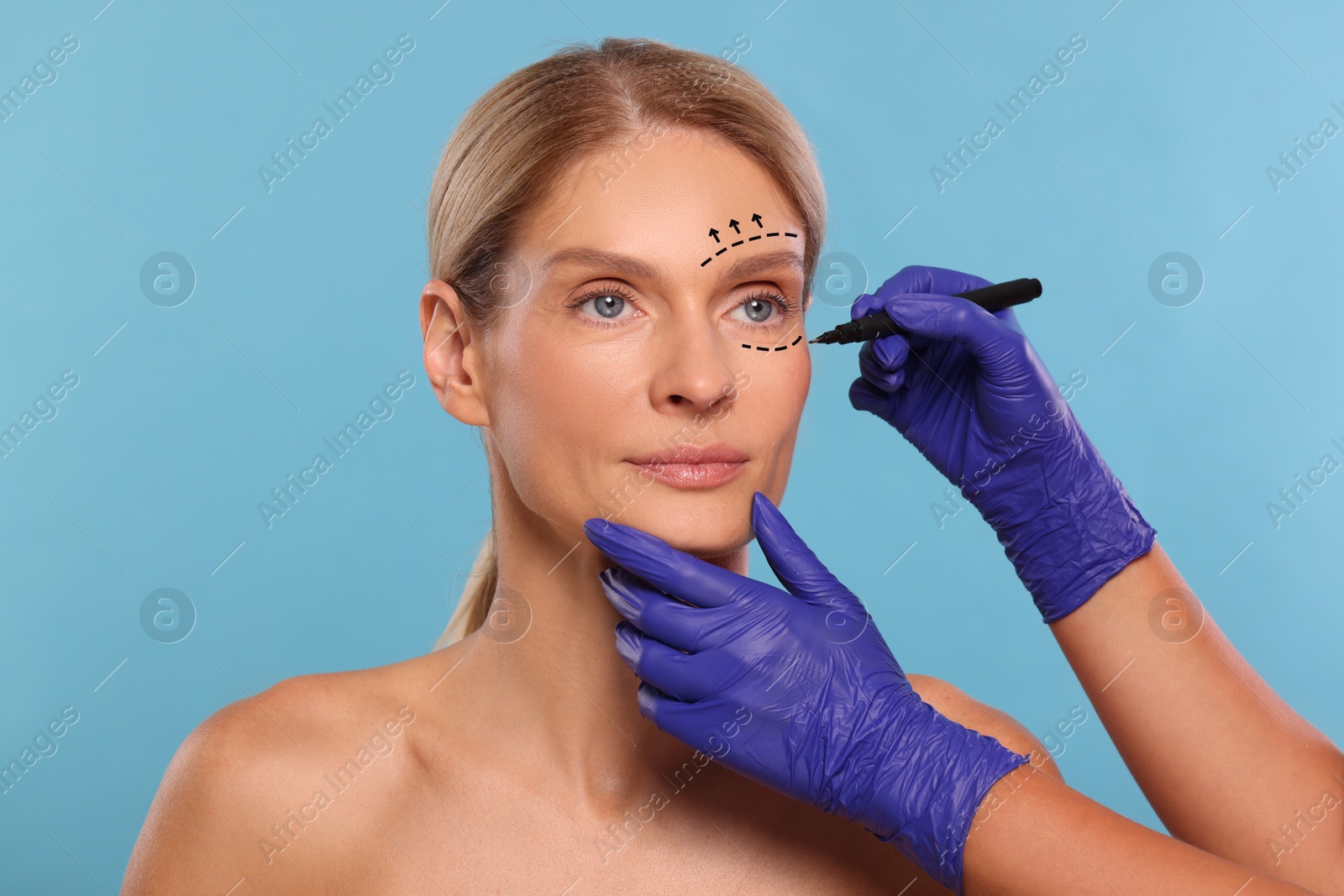 Image of Woman preparing for cosmetic surgery, light blue background. Doctor drawing markings on her face, closeup