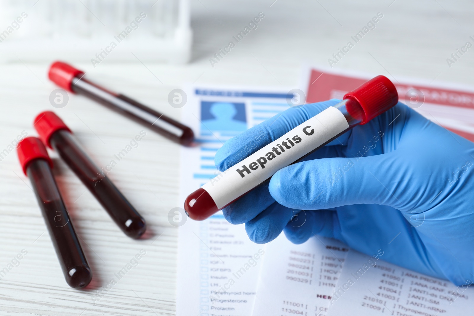 Photo of Scientist holding tube with blood sample and label Hepatitis C near laboratory test form, closeup