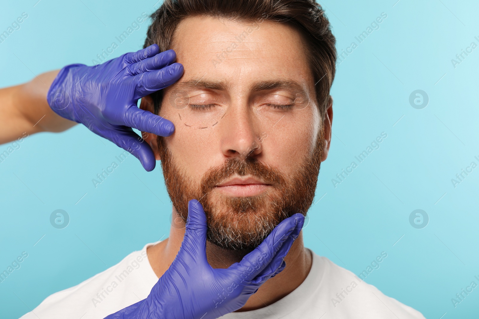 Photo of Doctor checking patient's face before cosmetic surgery operation on light blue background, closeup