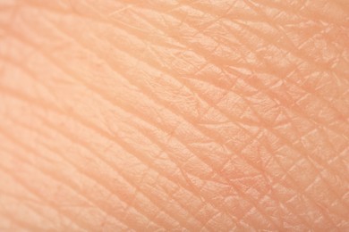 Photo of Texture of healthy skin as background, macro view