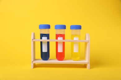 Photo of Test tubes with colorful liquids in wooden stand on yellow background. Kids chemical experiment set