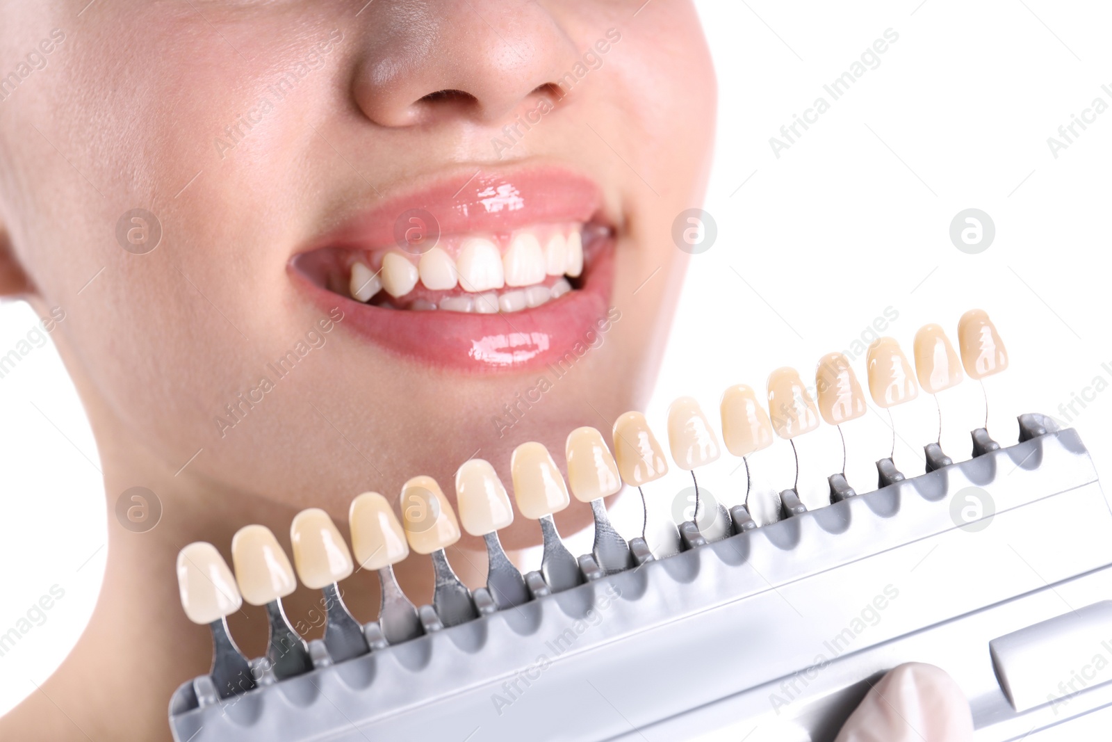 Photo of Dentist checking young woman's teeth color, closeup