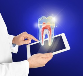 Image of Dentist with tablet and virtual model of tooth on blue background, closeup