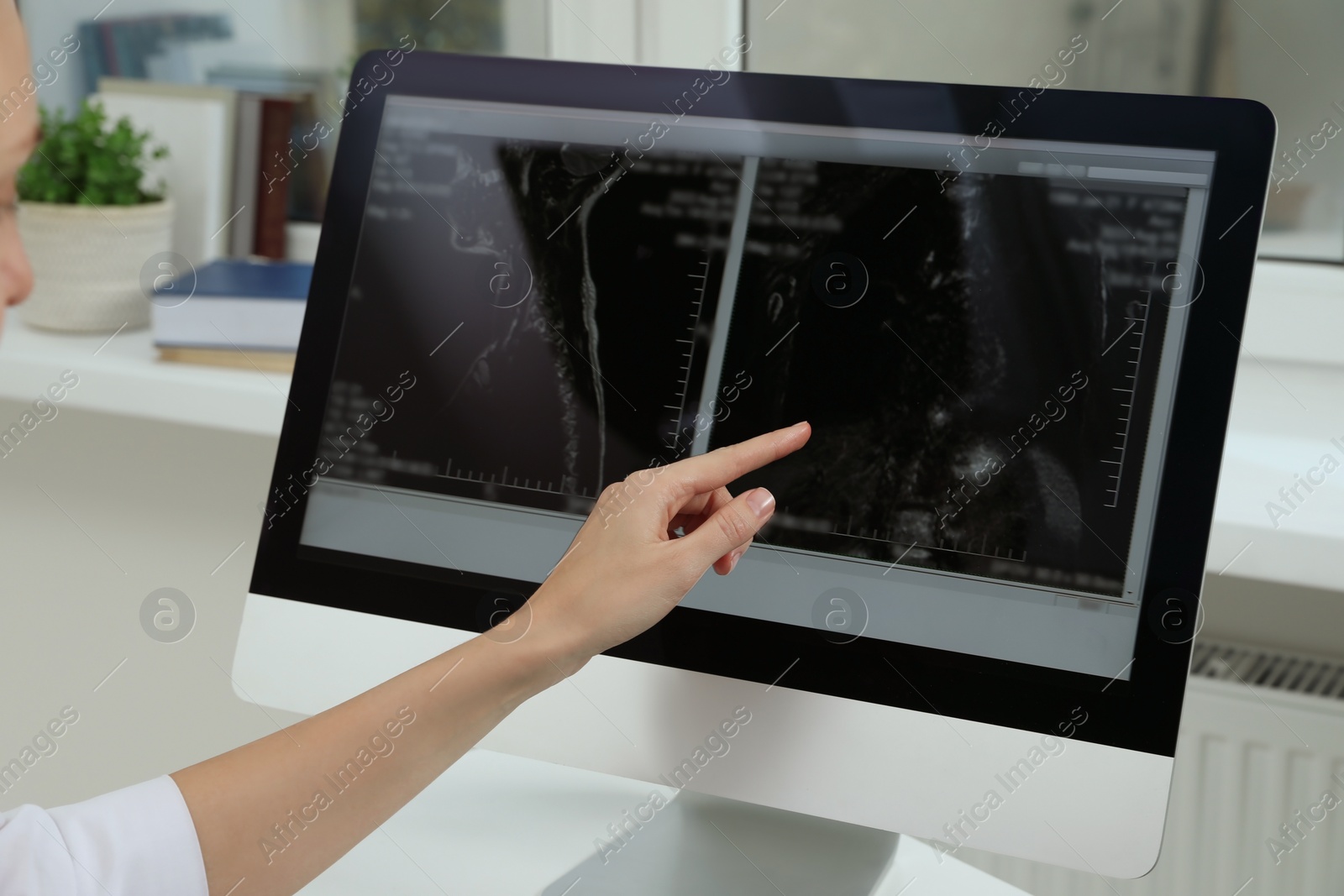 Photo of Doctor examining neck MRI image on computer in clinic, closeup