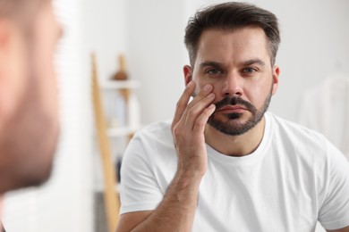 Photo of Confused man with skin problem looking at mirror indoors
