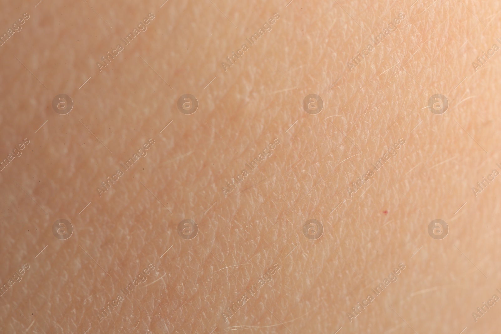 Photo of Texture of dry skin as background, macro view