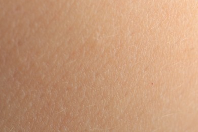 Texture of dry skin as background, macro view