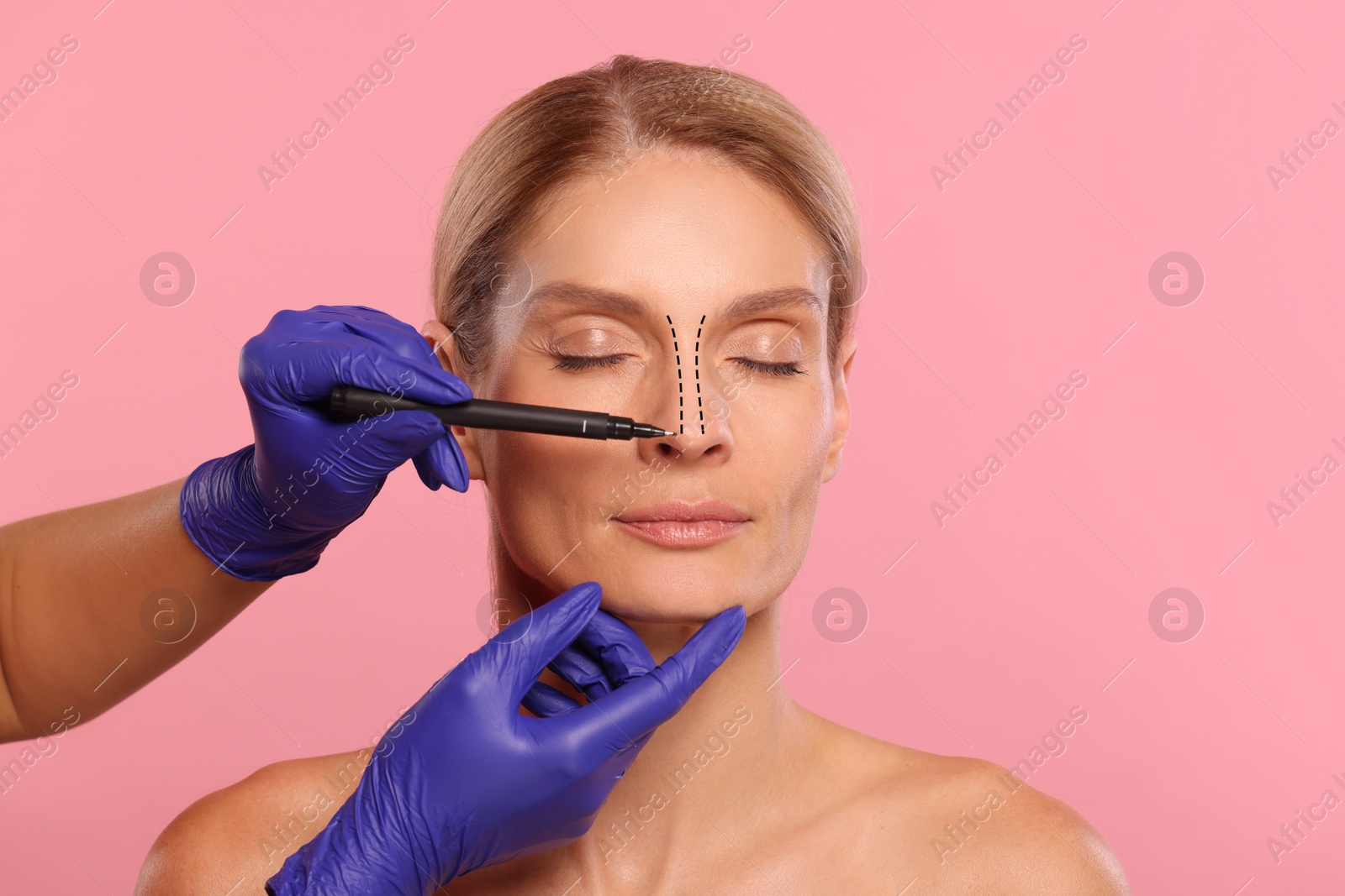 Image of Woman preparing for cosmetic surgery, pink background. Doctor drawing markings on her face, closeup