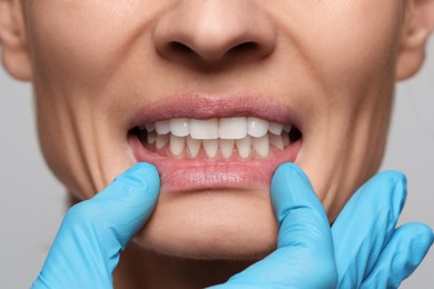 Photo of Doctor examining woman's gums on light background, closeup