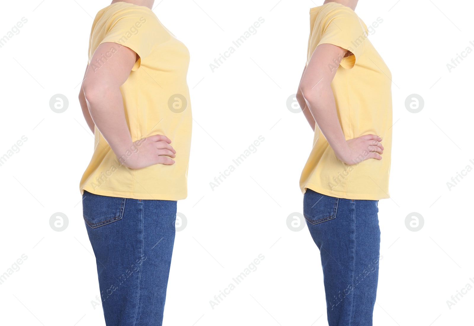 Image of Collage with photos of woman before and after weight loss diet on white background 