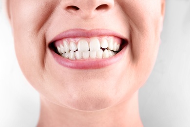 Photo of Young woman with healthy teeth smiling on white background, closeup