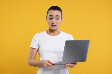 Embarrassed woman holding laptop on orange background