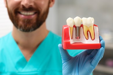 Dentist holding educational model of dental implant on blurred background, closeup. Space for text