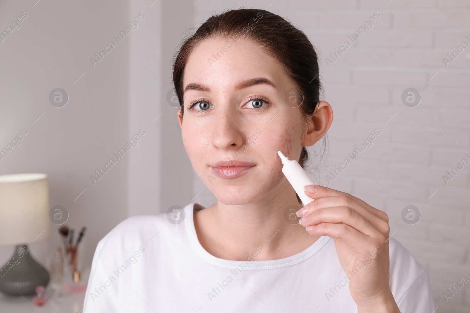 Photo of Woman with acne problem applying cream at home