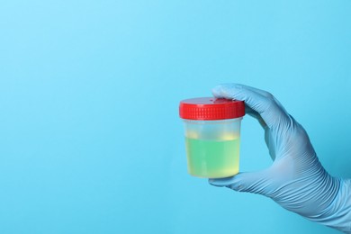 Photo of Doctor wearing glove holding container with urine sample for analysis on light blue background, closeup. Space for text
