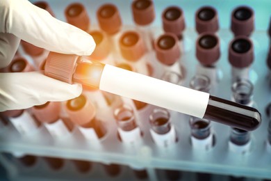 Laboratory worker holding test tube with blood sample over rack, closeup. Color toned